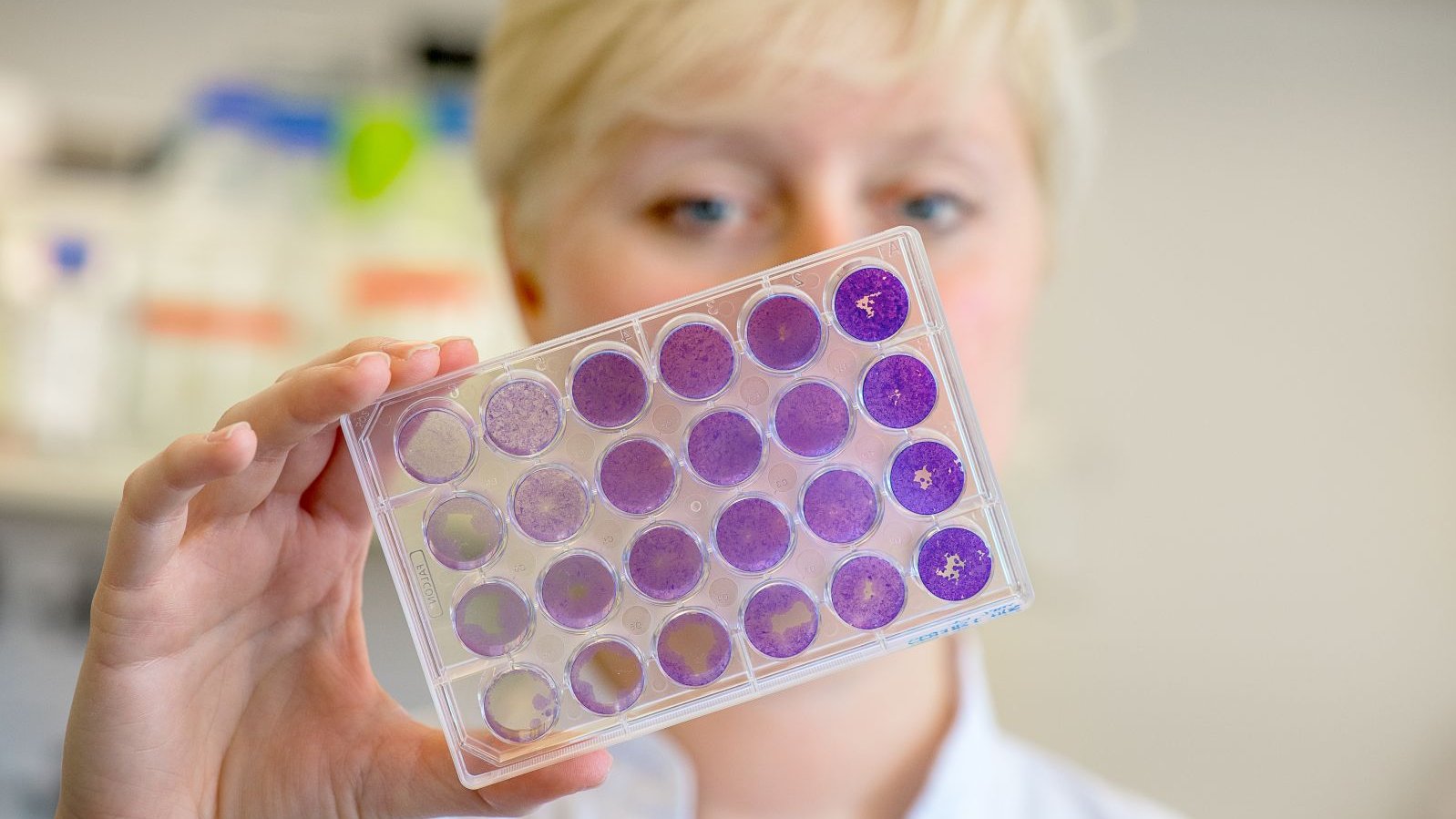 Female scientist in a laboratory for cancer research looking at a test rack.