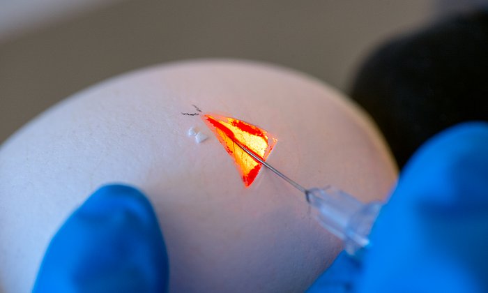 Scientists at TUM have created chickens and pigs with integrated genetic scissors. This can be used at all stages of the animals' development. They have already demonstrated applications in chicken embryos (image) as well as in living pigs.