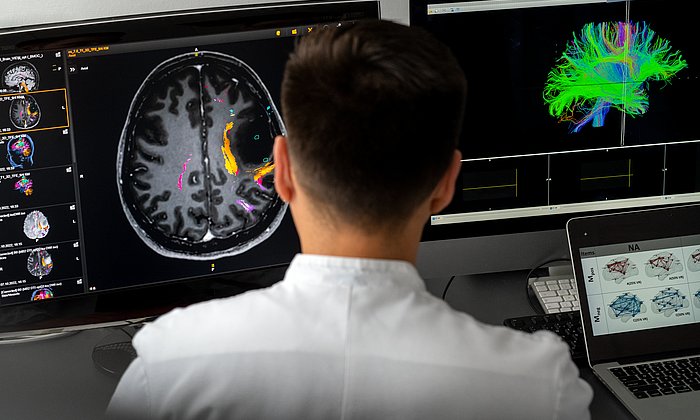 A scientist looking at brain imaging data