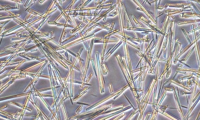 Aufnahmen von Harnsäurekristallen: Harnsäure bildet nadelförmige Kristalle, die das Immunsystem aktivieren. (Bild: K. Neumann/TUM)
