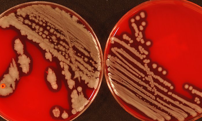 Typisches Wachstum von Bacillus cereus-Kolonien in Kulturschalen.