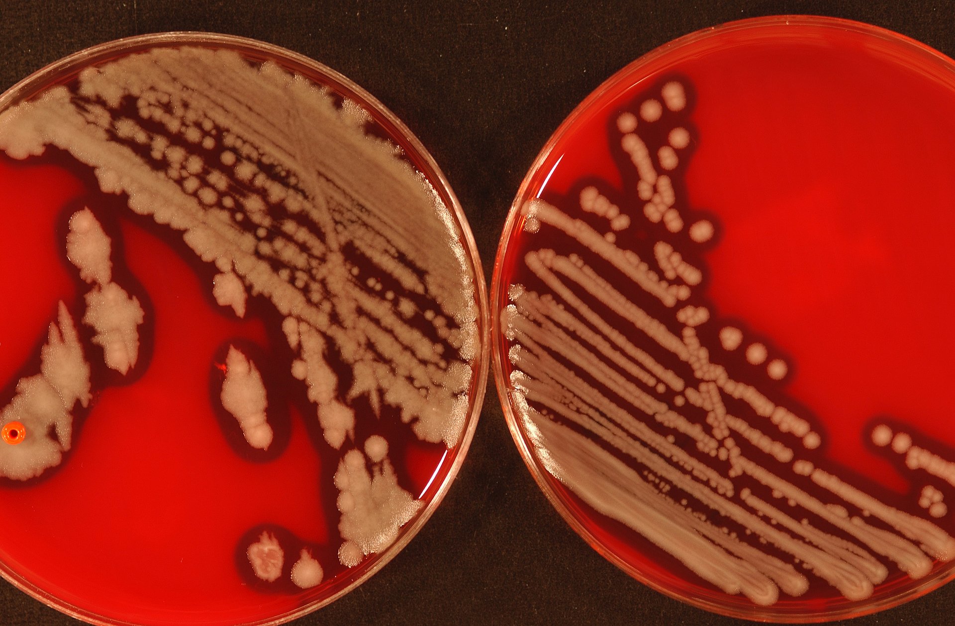 Typisches Wachstum von Bacillus cereus-Kolonien in Kulturschalen.