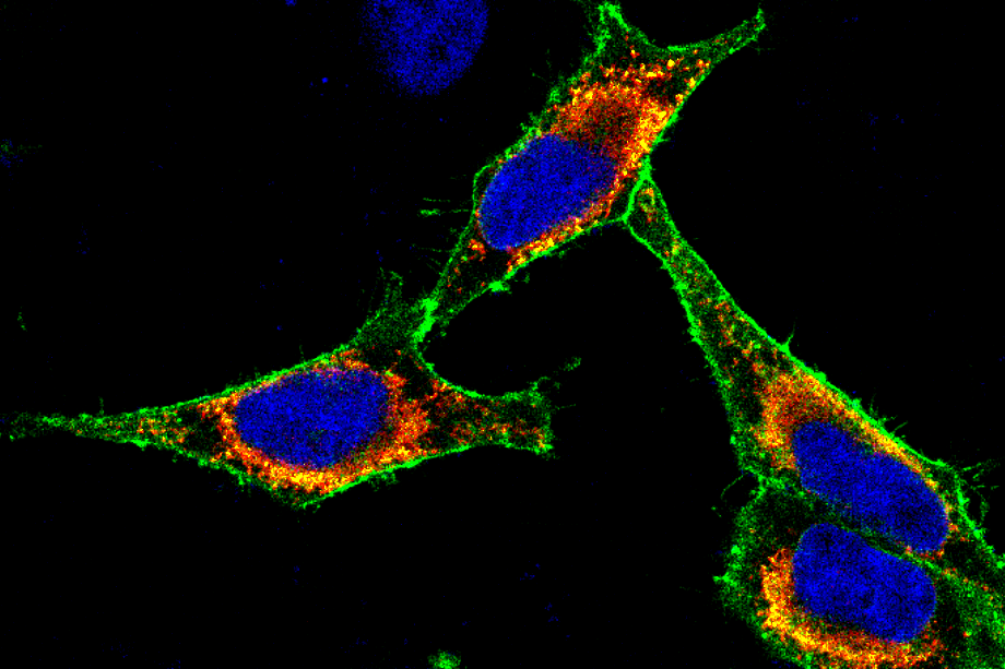 Immunfluoreszenzaufnahme von Krebszellen, bei denen ein Membranprotein mit einem grünen Fluoreszenzfarbstoff markiert wurde. Der Zellkern ist mit einem blauen Farbstoff gefärbt.