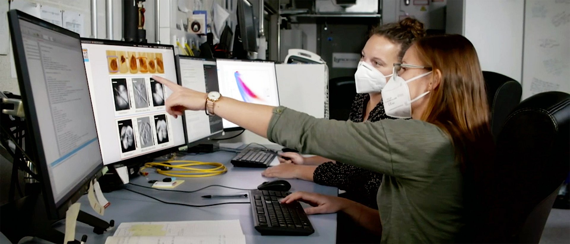 Evaluation of dark field x-ray images at the Munich Institute for Biomedical Engineering (MIBE) The dark field x-ray technology can reveal the damage to lung tissue caused by diseases such as COPD or Covid-19.