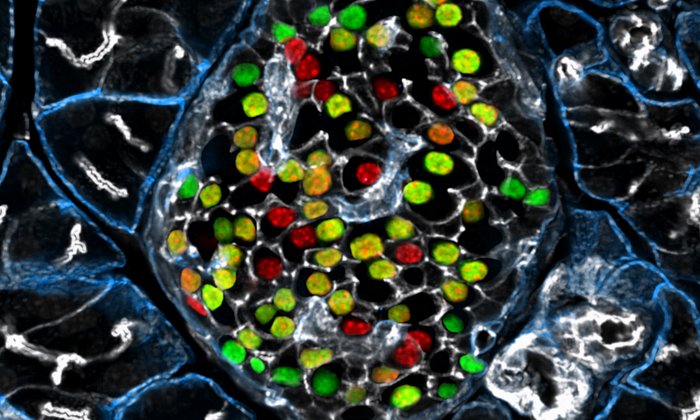 Beta cells marked in green and red. (Photo: Helmholtz Zentrum München)