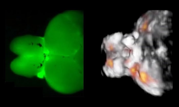 A fluorescence image of a zebrafish brain contrasted with a functional optoacoustic tomography image. (image: Razansky / TUM)
