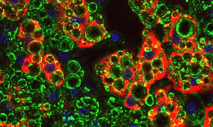 Mikroskopische Aufnahme von Fettzellen (grün). In Blaufärbung sieht man den Zellkern. Rot ist das so genannte UCP1, ein Transmembranprotein, das Wärme ohne Muskelaktivität wie etwa Zittern generieren kann.