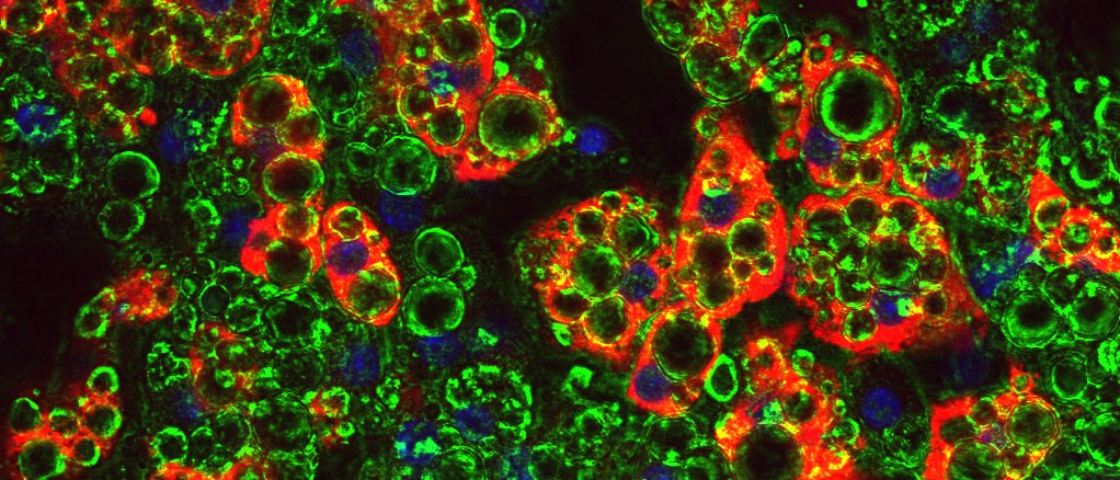 Mikroskopische Aufnahme von Fettzellen (grün). In Blaufärbung sieht man den Zellkern. Rot ist das so genannte UCP1, ein Transmembranprotein, das Wärme ohne Muskelaktivität wie etwa Zittern generieren kann.