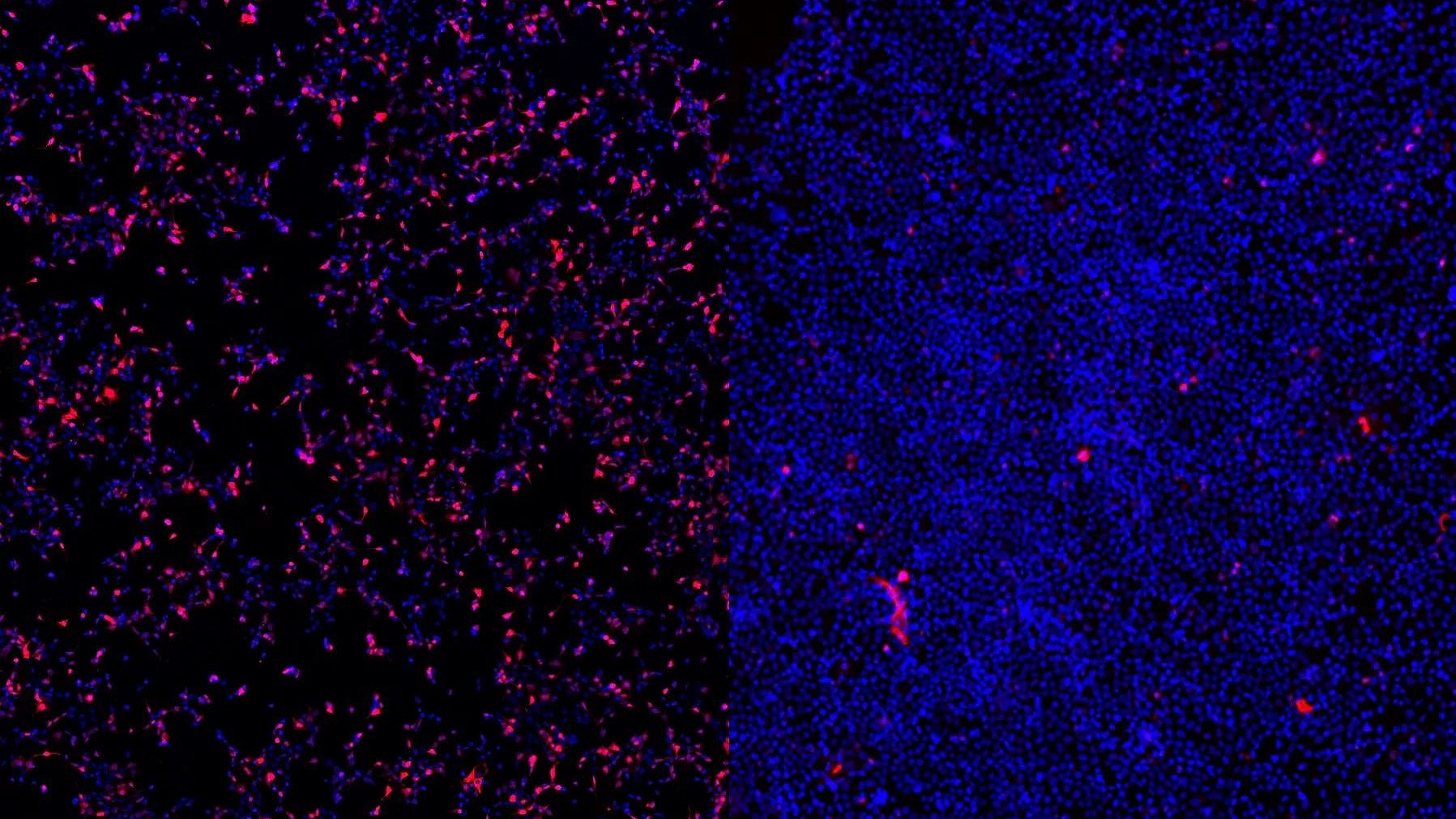 Cell uptake ASO therapies Cell uptake ASO therapies