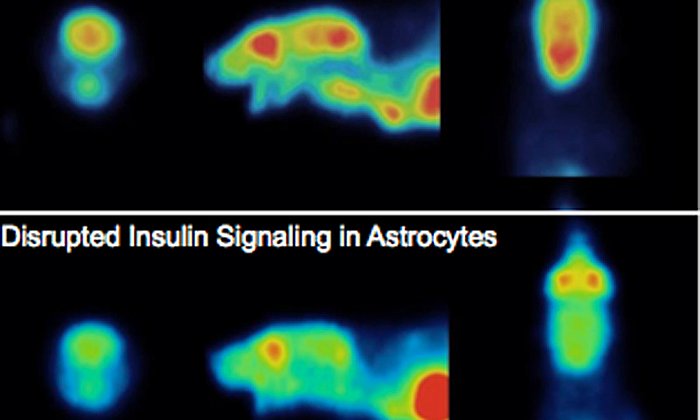 Insulin wirkt an Stützzellen, um die Aufnahme von Zucker ins Gehirn zu regulieren. Oben ist eine solche intakte Signaltransaktion zu sehen, unten ist sie gestört. (Quelle: Garcia-Caceres)