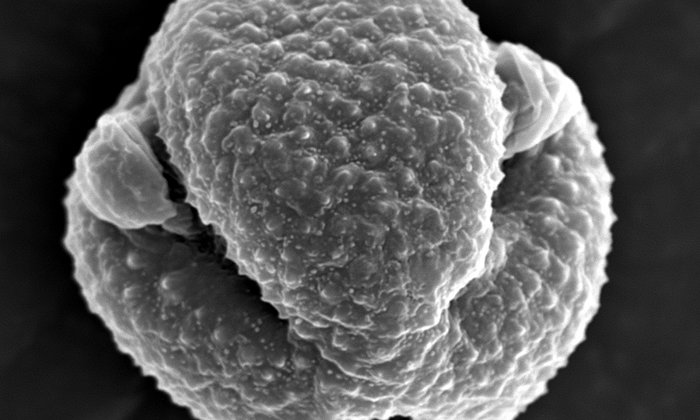 Aufnahme eines Rasterelektronenmikroskops (REM) von einem Artemisia-Pollen. (Bild: J. Buters / TUM)
