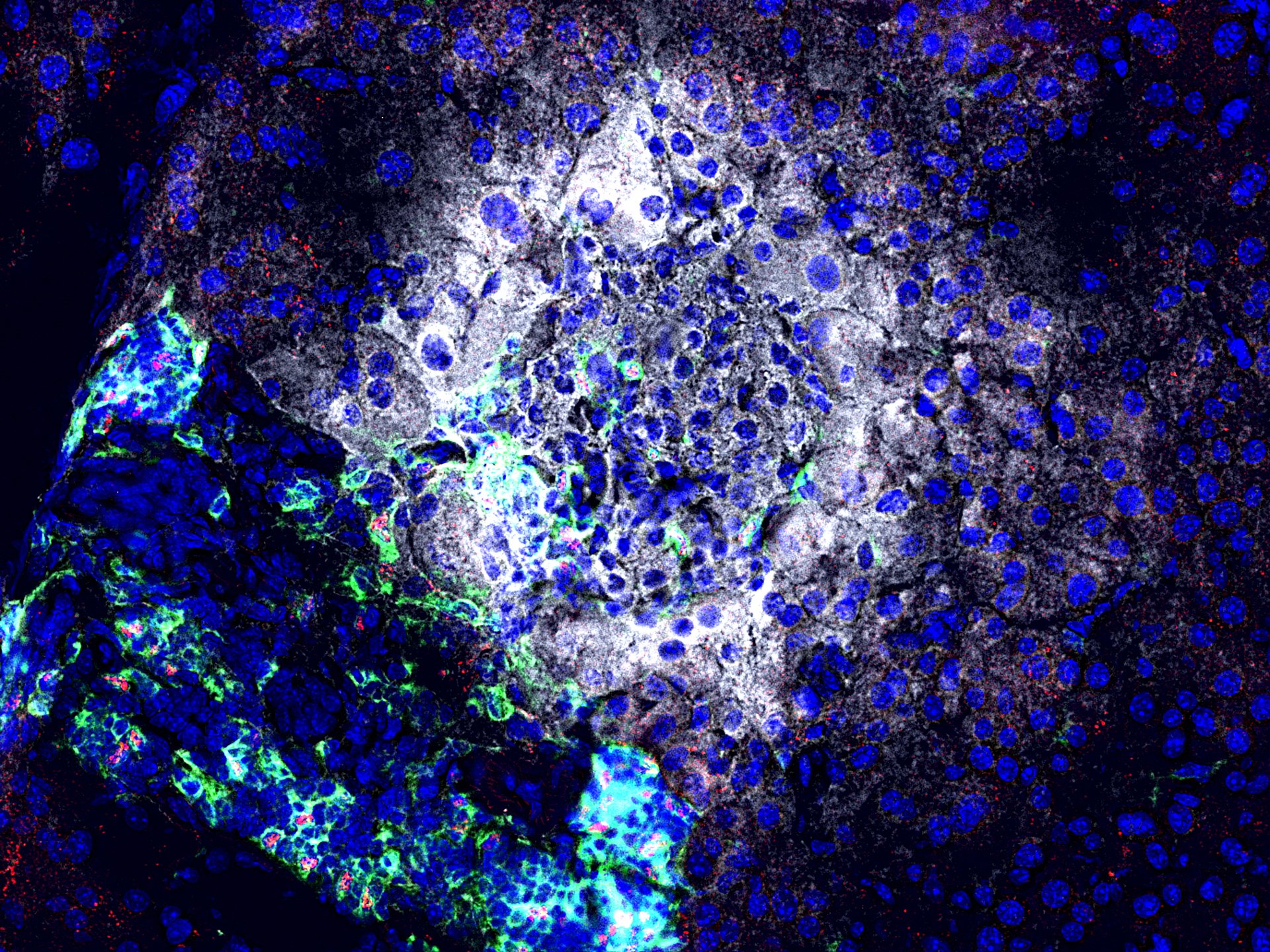 Nach Gabe eines Antagomir gegen miR92a werden Insulin (weiß) produzierende Betazellen seltener von Immunzellen (grün) angegriffen. Zudem sind mehr regulatorische T Zellen (rot) vorhanden, die die Betazellen (weiß) schützen können. (Foto: Helmholtz Zentrum München)