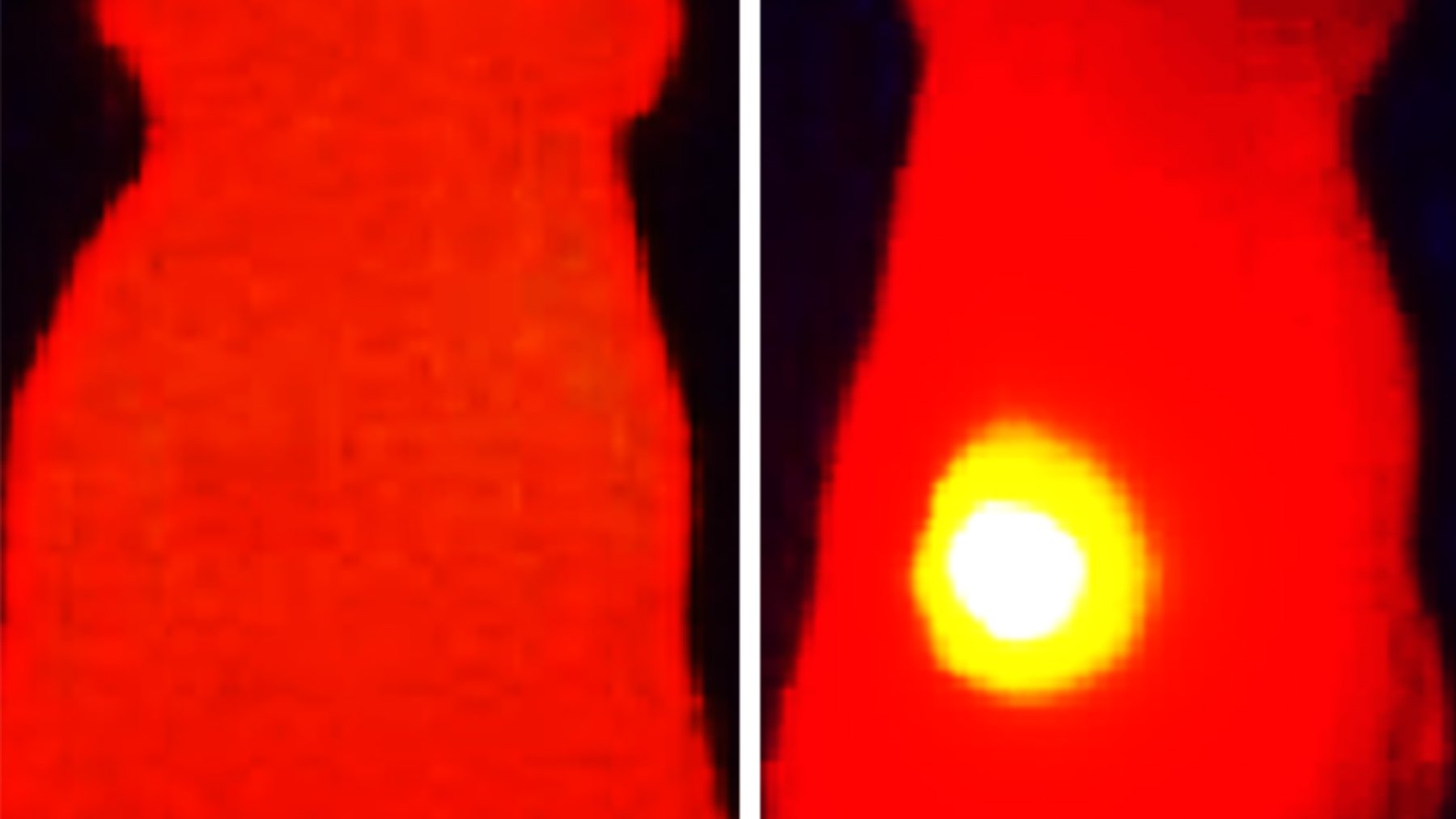 Das Infrarot-Wärmebild auf der rechten Seite zeigt eine Maus, die mit OMVs mit Melanin behandelt wurde. Der Tumor (gelb) zeigt eine Temperaturerhöhung nach der Laserbestrahlung. Auf der linken Seite wurde die Maus mit OMVs ohne Melanin behandelt. 