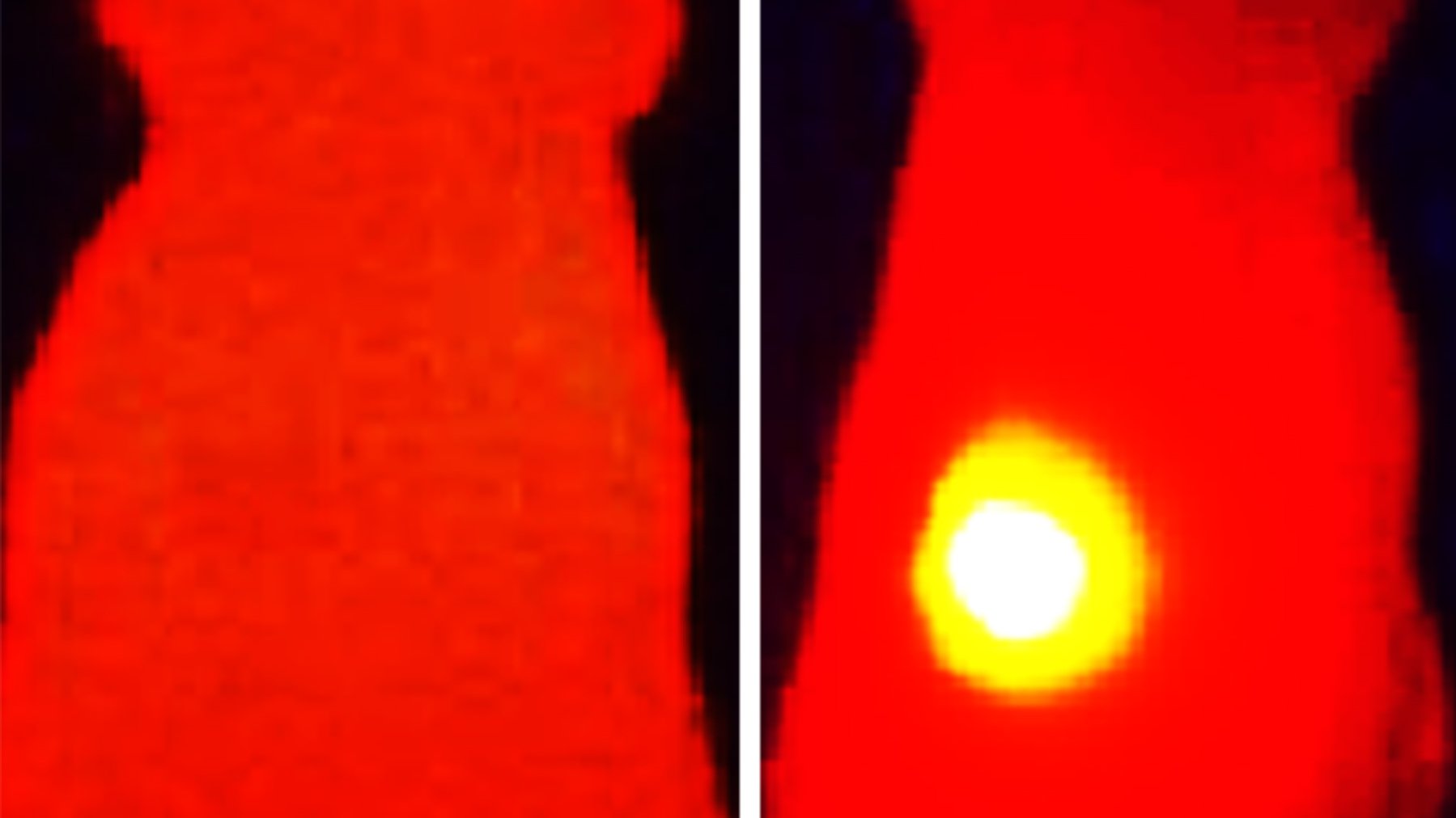Das Infrarot-Wärmebild auf der rechten Seite zeigt eine Maus, die mit OMVs mit Melanin behandelt wurde. Der Tumor (gelb) zeigt eine Temperaturerhöhung nach der Laserbestrahlung. Auf der linken Seite wurde die Maus mit OMVs ohne Melanin behandelt. Das Infrarot-Wärmebild auf der rechten Seite zeigt eine Maus, die mit OMVs mit Melanin behandelt wurde. Der Tumor (gelb) zeigt eine Temperaturerhöhung nach der Laserbestrahlung. Auf der linken Seite wurde die Maus mit OMVs ohne Melanin behandelt.