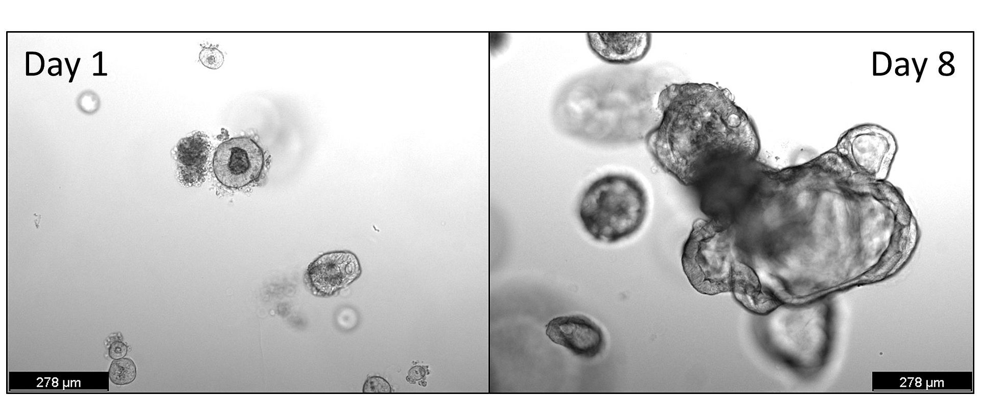Humane Organoide gezüchtet aus Dünndarmgewebe (Zwölffingerdarm, Duodenum). Mikroskopie von Darmzellen.