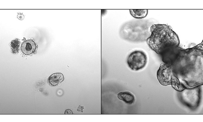 microscopy of intestinal cells