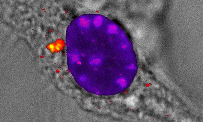 Die Abbildung zeigt eine Fluoreszenzaufnahme von Virus-DNA-Rad50-Card9-Komplexen (gelb) im Zytoplasma (Transmissionsbild) einer Zelle. Nach Infektion der Zelle mit einem DNA-Virus markieren die Wissenschaftler die einzelnen Moleküle, die sie in der Zelle beobachten möchten, mit unterschiedlichen fluoreszierenden Farbstoffen. In blau/magenta leuchtet die DNA, in grün Rad50 und in rot Card9.  (Bild: A. Rottach / LMU)