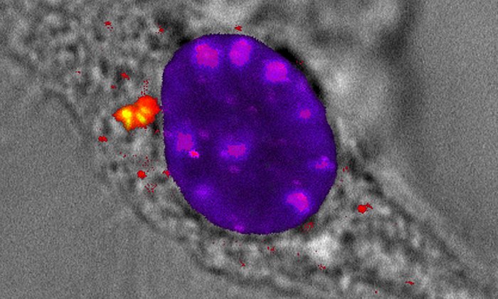 The illustration shows a fluorescence image of viral-DNA-Rad50-CARD9 complexes (yellow) in the cytoplasm (transmission light) of a cell. After infecting the cell with a DNA virus, the scientists mark the individual molecules to be observed in the cell with different fluorescent dyes. Here, the DNA is represented in blue/magenta, Rad50 in green and Card9 in red. (Image: A. Rottach / LMU)