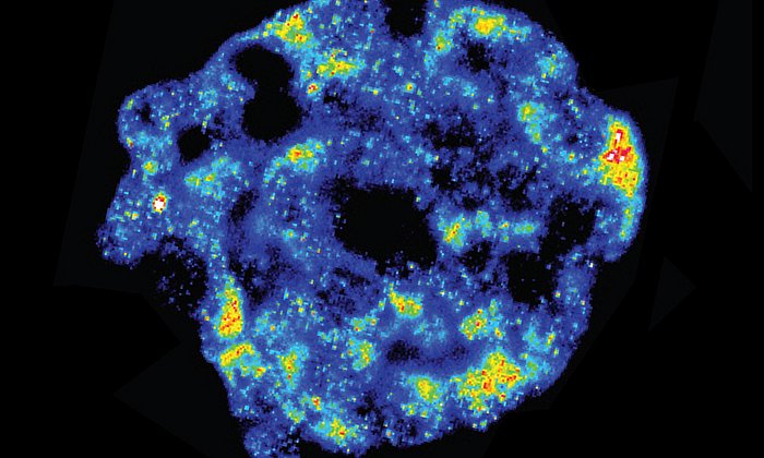 Fluorescence- in-situ-hybridization shows mRNA-activity in a tissue sample. Blue: low, red: high activity – Image: S. S. Bajikar / University of Virginia, Charlottesville (USA)