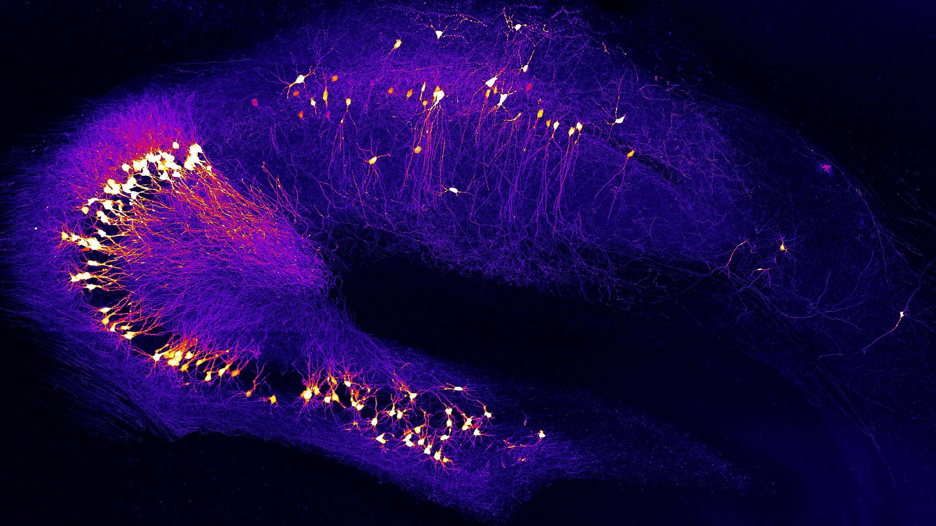 Neurons in the hippocampus, a brain region for learning and memory, that is impaired already at early stages of Alzheimer´s disease.