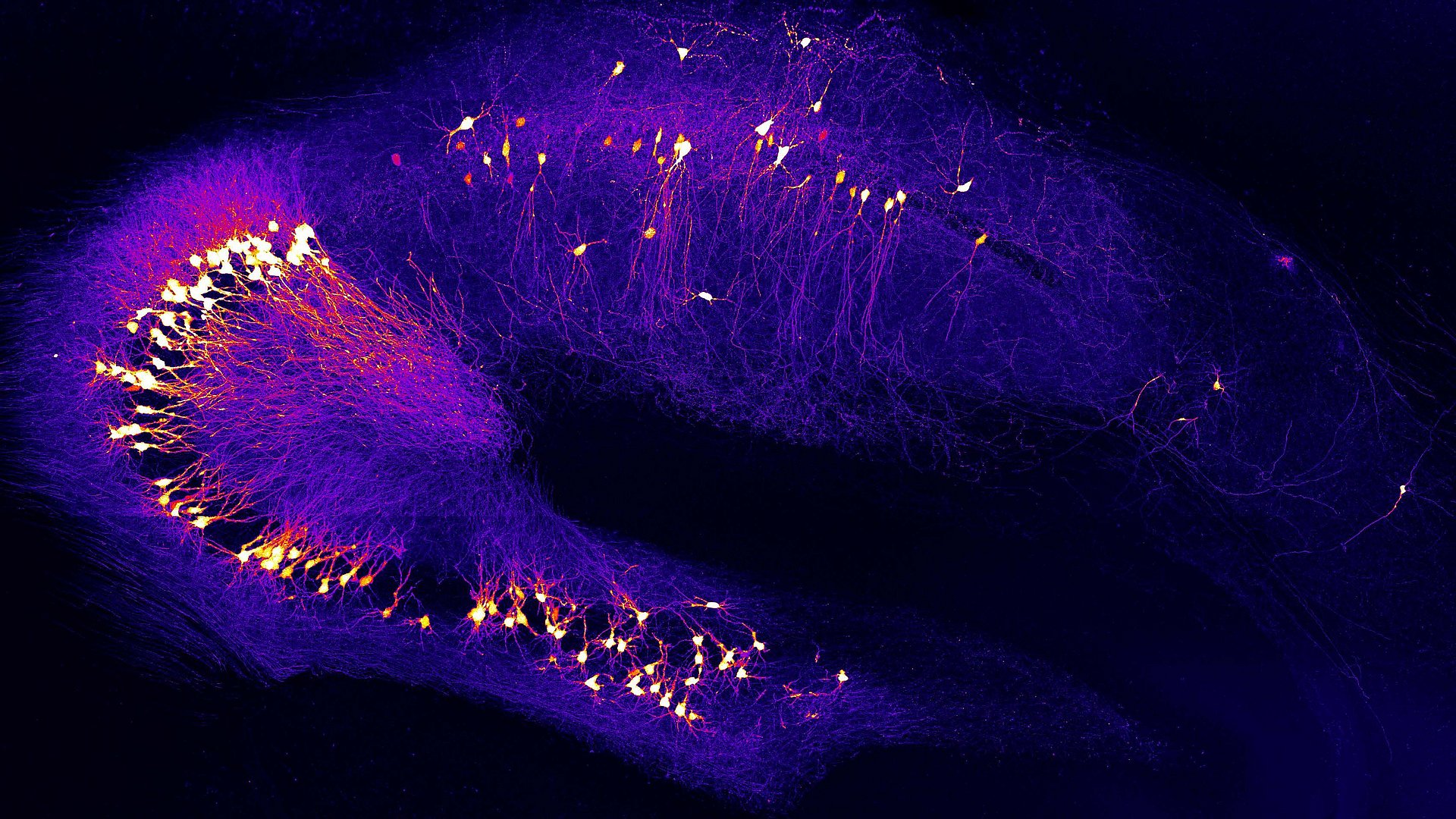 Nervenzellen im Hippocampus, einem Hirngebiet für Lernen und Gedächtnis, das früh von Alzheimer betroffen ist.