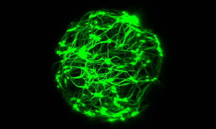 Reconstitution of active cytoskeletal vesicles. The active cytoskeleton (green)exerts forces to the surrounding lipid membrane – Image: Etienne Loiseau / TUM