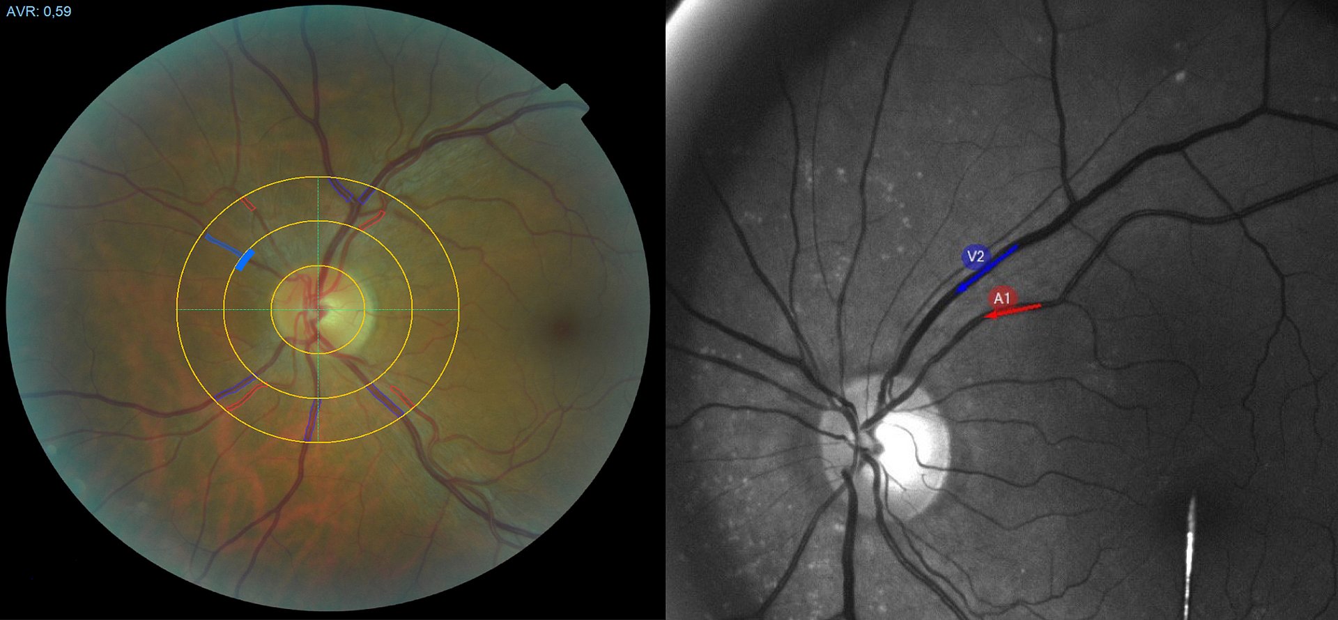 Two images from eye examinations