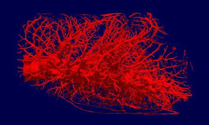 3D-Neutron tomography of a rat lung. (Image: Robert Metzke, Burkhard Schillinger, TU München)