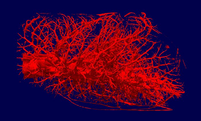 3D-Tomografie einer Säugetierlunge. (Bild: Robert Metzke, Burkhard Schillinger, TU München)