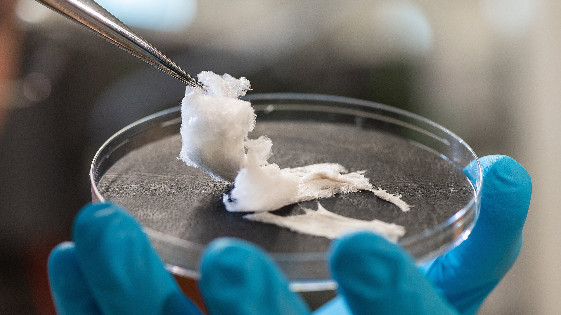  Mucin that has been freeze-dried. These molecules play an important role for the newly developed biomolecular film for woundhealing. 