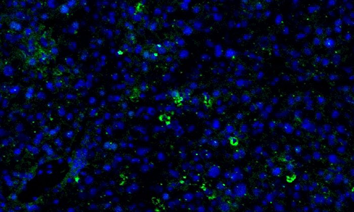 The microscopic picture shows liver cells whose nuclei have been stained with blue fluorescent dye. The formation of metastasis-promoting signaling molecule (SDF1, marked in green) in the liver is triggered by TIMP-1. (Picture: A. Krüger / TUM)