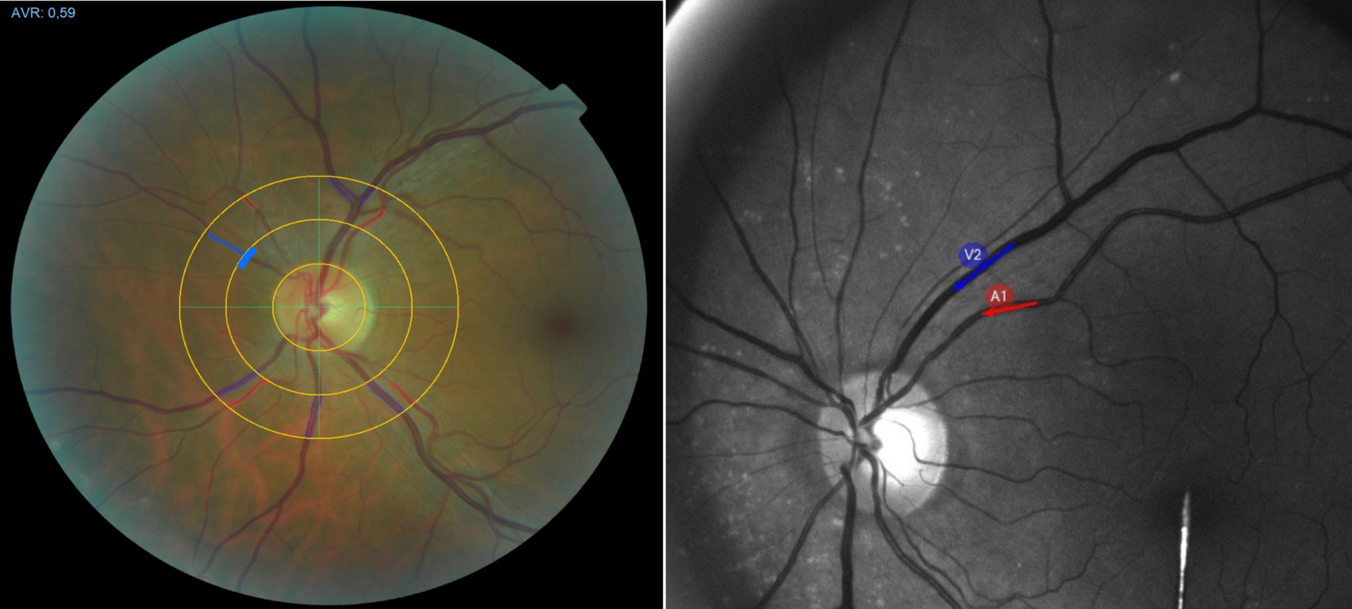 Two images from eye examinations