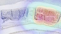 Image composition: A tissue section overlaid with PET imaging data.