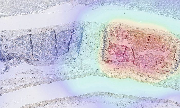 Image composition: A tissue section overlaid with PET imaging data.
