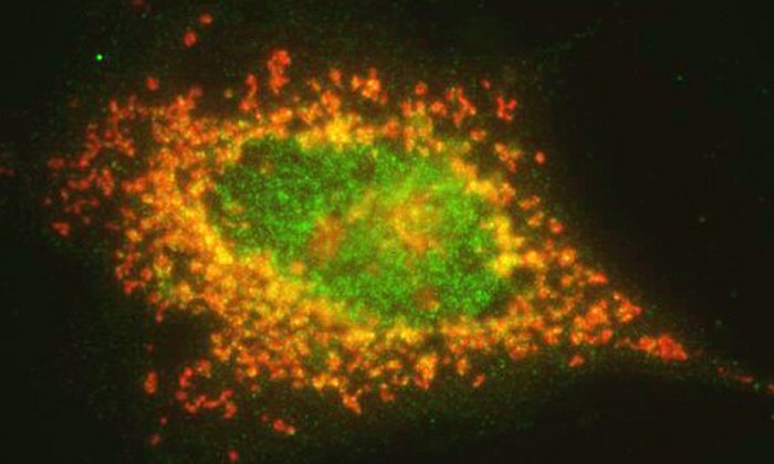 Die fluoreszenzmikroskopische Aufnahme zeigt die Ubiquitin-Ligase FBXO25 (grün) und das überlebenssichernde Protein (rot) in einer Krebszelle, die gerade den Zelltod einleitet. Das gelbe Signal zeigt an, wenn beide Proteine am selben Ort sind. (Bild: F. Bassermann / TUM)