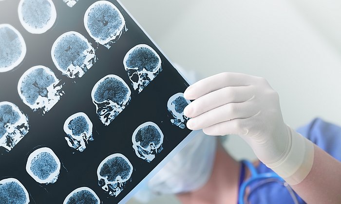 CT-scans of a skull