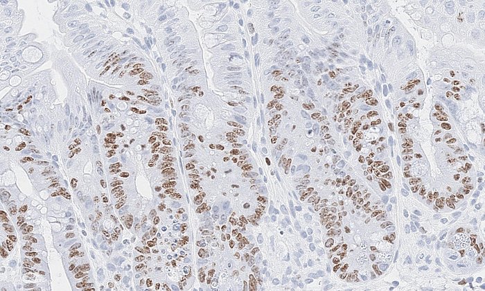 Darmzellen in einem Gewebeschnitt
