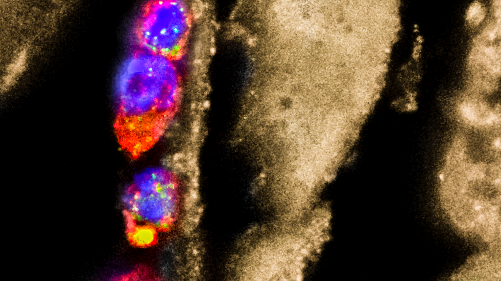 Entzündungshemmende Makrophagen (bunt), die auf Parasiten-Larven „sitzen“.