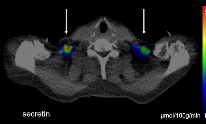 Imaging techniques show how brown fat is activated in in a depot above the clavicle by the hormone secretin.