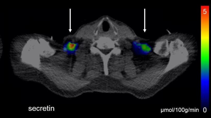 Imaging techniques show how brown fat is activated in in a depot above the clavicle by the hormone secretin.