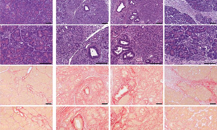 Cerulein-induced chronic pancreatitis was exacerbated in TRPV6mut/mut mice.