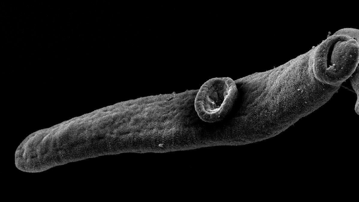 Microscopic image of a juvenile blood fluke (Schistosomia mansoni).