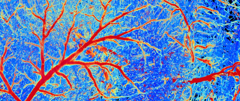 Detail of the brain vasculature of a mouse. 