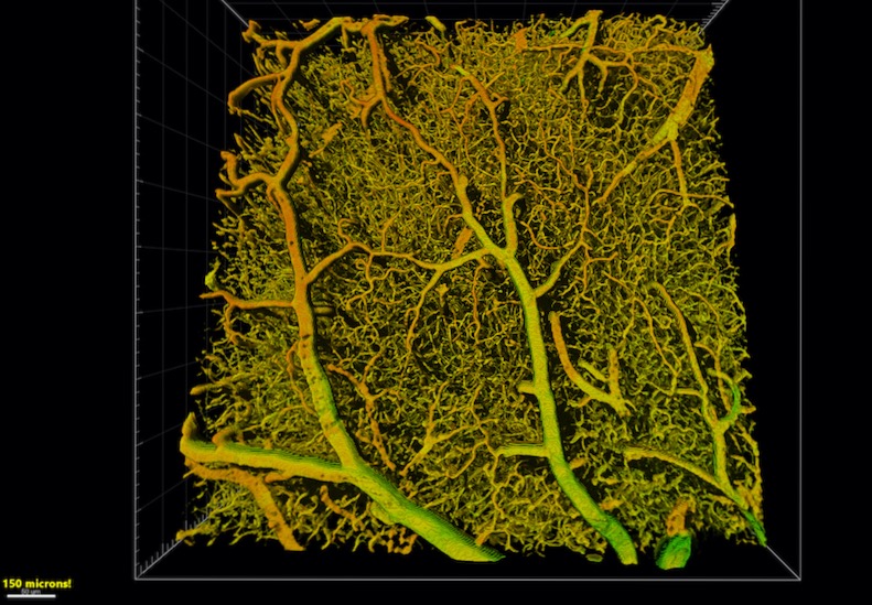 Detail of the brain vasculature of a mouse reconstructed using deep learning. The reconstruction is based on an image created using high-resolution fluorescent microscopy. 