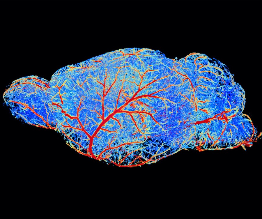 Rekonstruktion des kompletten Gefäßgeflechts im Gehirn einer Maus mithilfe Künstlicher Intelligenz. Der verwendete KI-Algorithmus macht es unter anderem möglich, die Durchmesser aller Blutgefäße zu bestimmen. 