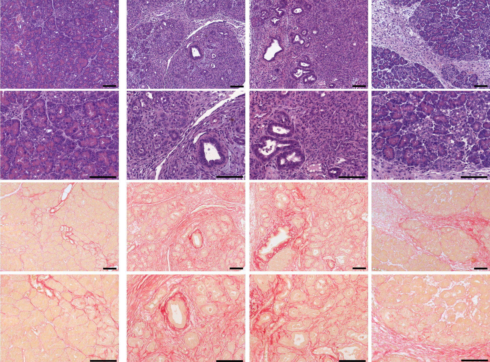 Cerulein-induced chronic pancreatitis was exacerbated in TRPV6mut/mut mice.