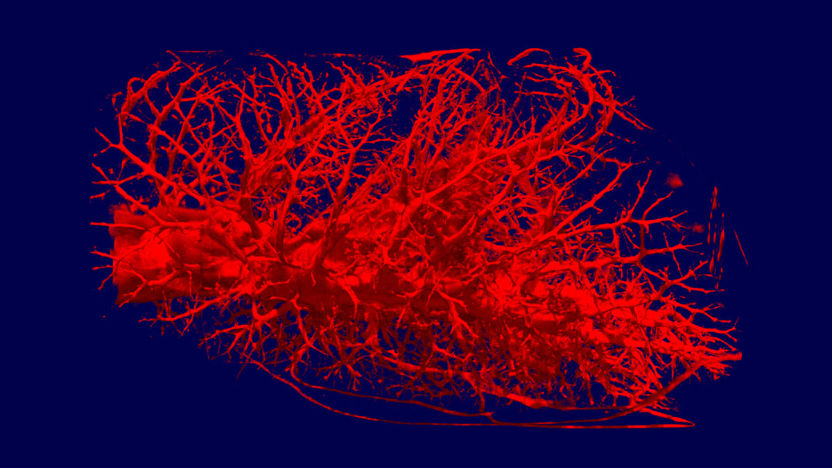 3D-Neutron tomography of a rat lung. (Image: Robert Metzke, Burkhard Schillinger, TU München)