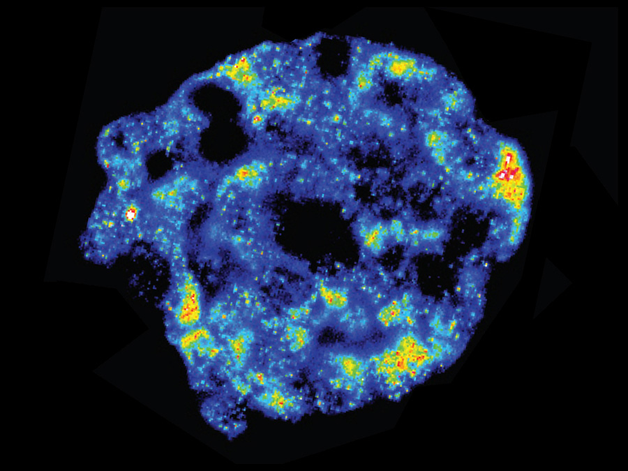 Fluorescence- in-situ-hybridization shows mRNA-activity in a tissue sample. Blue: low, red: high activity – Image: S. S. Bajikar / University of Virginia, Charlottesville (USA)