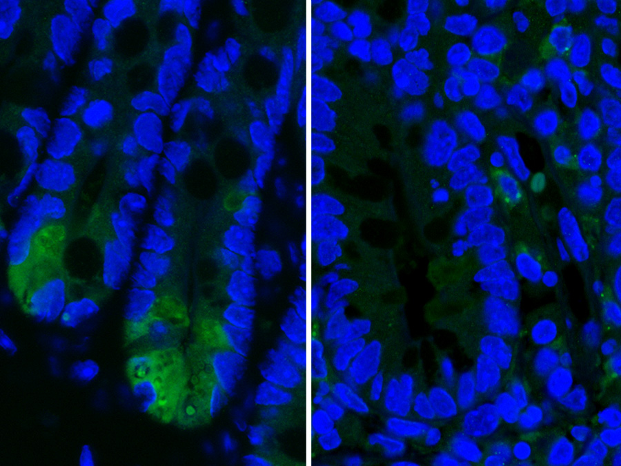 The images show Paneth cells in the small intestine. These cells play an important role in immune defense. In mice with Crohn’s-type inflammation, the Paneth cells produce less lysozyme, an important anti-microbial enzyme. Left: Healthy cells producing high levels of lysozyme (light green); right: Damaged Paneth cells producing low levels of lysozyme.