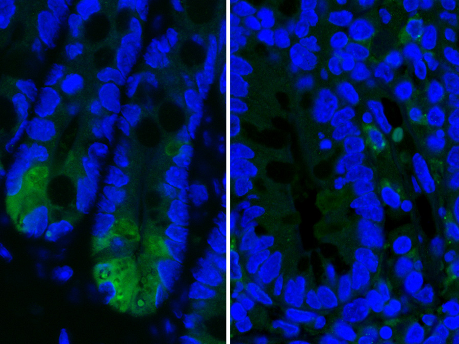 Die Bilder zeigen Paneth-Zellen im Dünndarm, die bei der Immunabwehr eine wichtige Rolle spielen. Bei Mäusen mit Morbus-Crohn-ähnlicher Entzündung produzieren die Paneth-Zellen weniger Lysozym - eine Substanz, die wichtig für die Mikroben-Abwehr ist. Links: gesunde Zellen mit hoher Lysozym-Produktion (helles grün), rechts geschädigte Paneth-Zellen mit geringer Lysozym-Produktion.